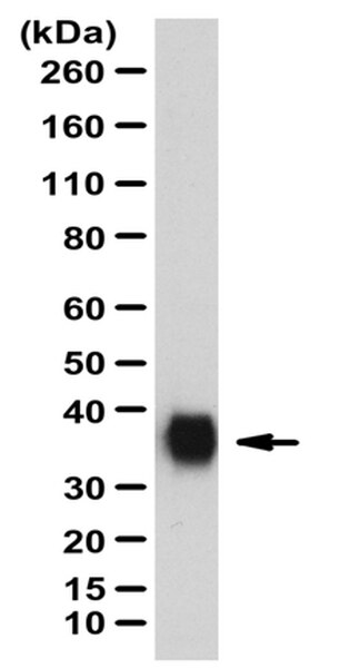 Anti-surfactant Protein A Antibody 